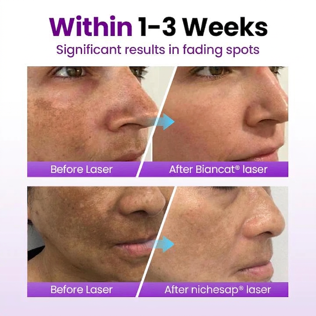 nichesap® SpotErase Probiotic Shield Serum