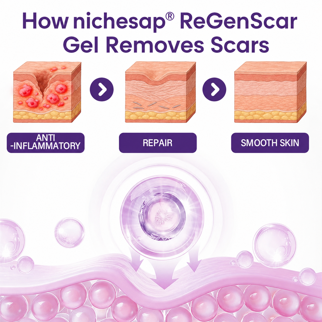nichesap® ReGenScar Stem Cell Scar Gel | Say goodbye to stubborn scars