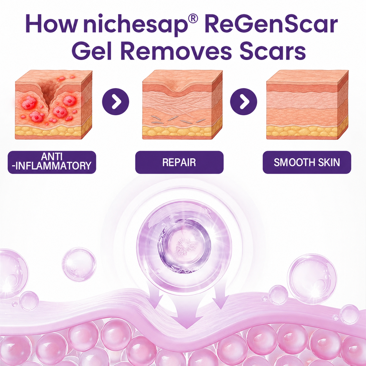 nichesap® ReGenScar Stem Cell Scar Gel | Say goodbye to stubborn scars