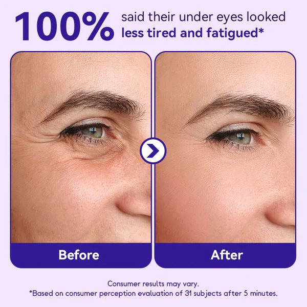 Nichesap ® Instant Lift Eye Gel — Reduce the Look of Eye Bags in Minutes 🔥