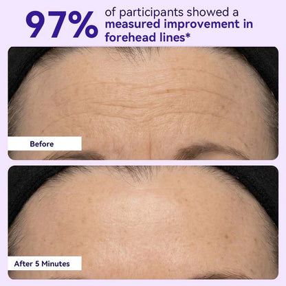 Nichesap ® Instant Lift Eye Gel — Reduce the Look of Eye Bags in Minutes 🔥