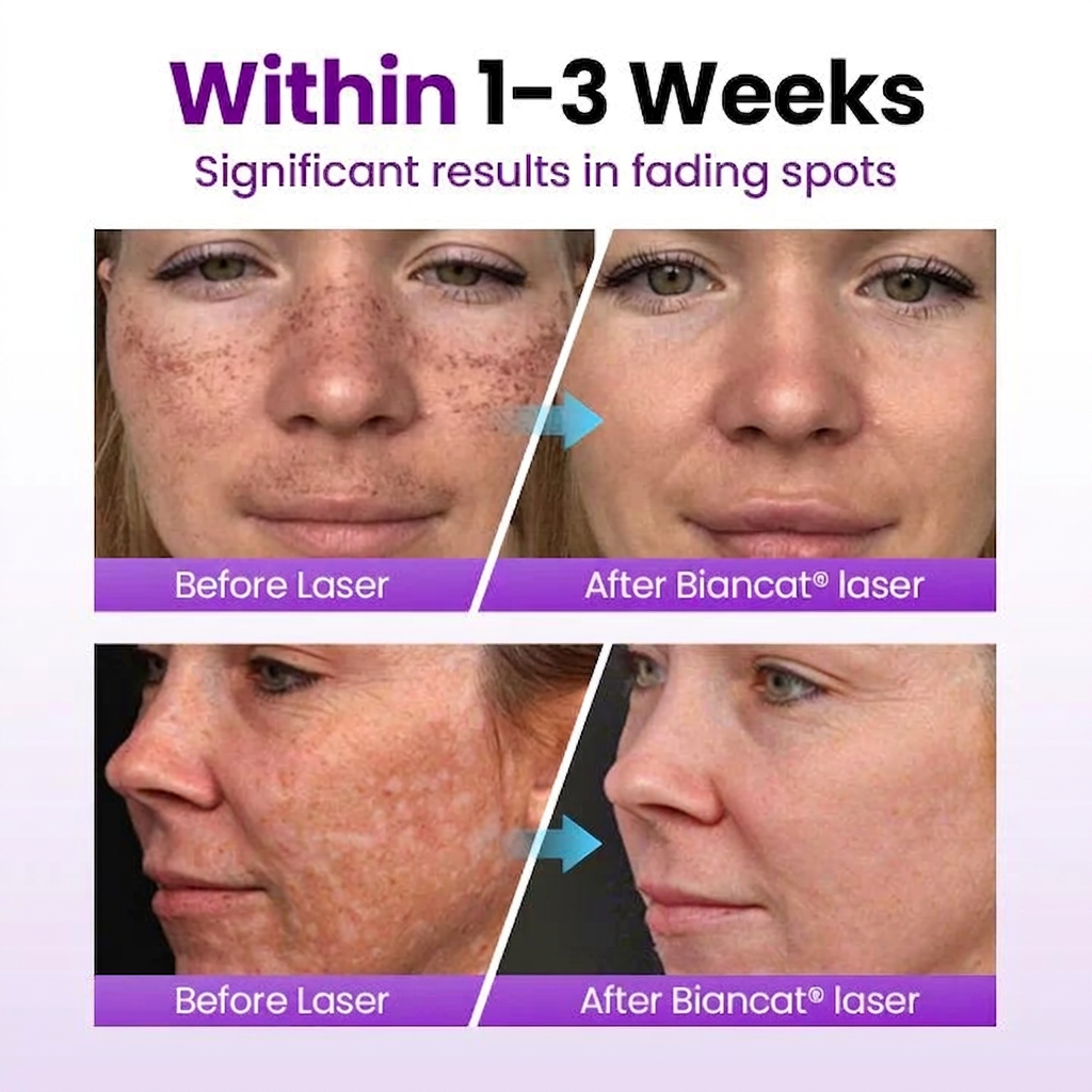nichesap® SpotErase Probiotic Shield Serum