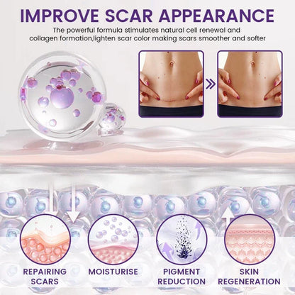 Mirecult® ReGenScar Stem Cell Scar Gel | Say goodbye to stubborn scars