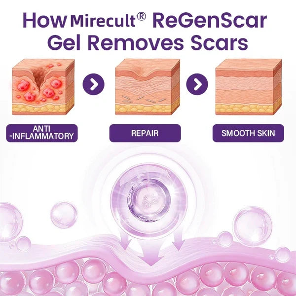 Mirecult® ReGenScar Stem Cell Scar Gel | Say goodbye to stubborn scars