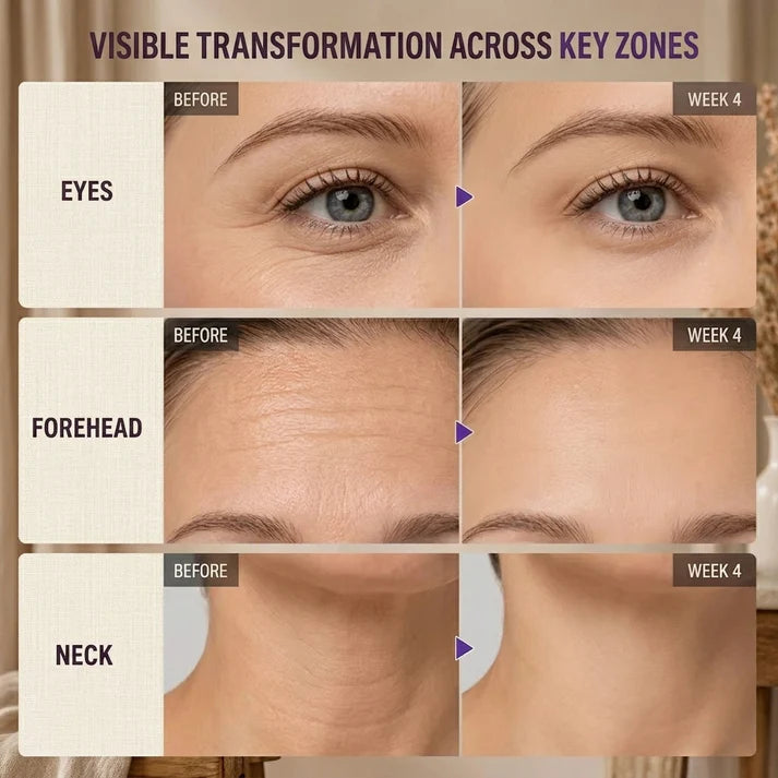 Targets All Types of Wrinkles for Younger-Looking Skin ⭐-III