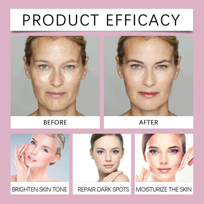 Advanced Dark Spot Corrector Serum - Multi-Correction Brightening Formula for Sun Spots, Age Spots, and Melasma