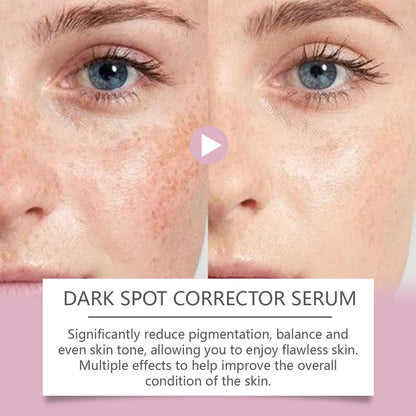 Advanced Dark Spot Corrector Serum - Multi-Correction Brightening Formula for Sun Spots, Age Spots, and Melasma