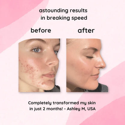 brightening turmeric & kojic acid pads