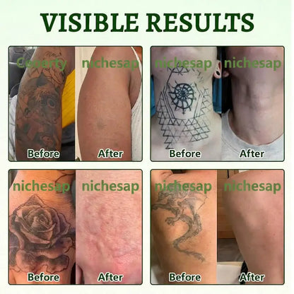 Nichesap® PureAlgae Ink Removal Support Spray&Painless & Fast Tattoo Removal