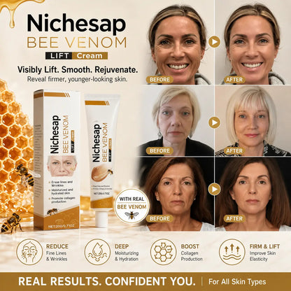 Bee Venom Lifting Cream - Erase Wrinkles & Fine Lines Instantly! Instant Face Lift & Collagen Booster for Youthful, Plumping Skin