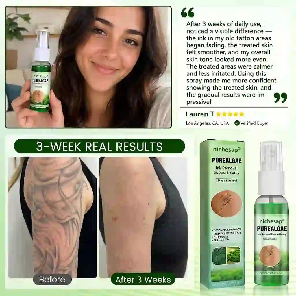 Nichesap® PureAlgae Ink Removal Support Spray&Painless & Fast Tattoo Removal