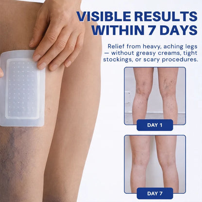 Vein ContourMicroneedle Patch with AdvancedDiosmin & Hesperidin Delivery 🌿 7-Day Visible Results for VaricoseVeins