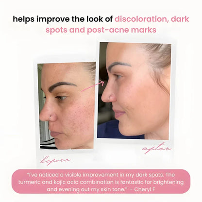 brightening turmeric & kojic acid pads